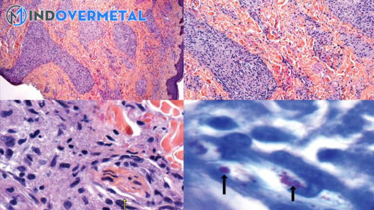 Đặc điểm của Staphylococcus Haemolyticus phân loại hình thái sinh