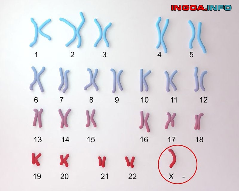 xet-nghiem-monosomy-x-60-la-gi-co-anh-den-thai-nhi-7