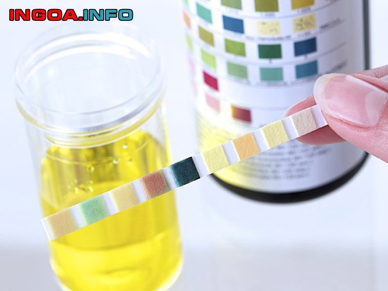 xet-nghiem-tpu-la-gi-y-nghia-tung-thong-so-trong-nuoc-tieu-1