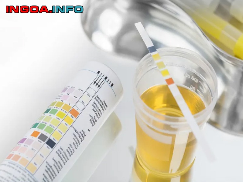 xet-nghiem-tpu-la-gi-y-nghia-tung-thong-so-trong-nuoc-tieu-4