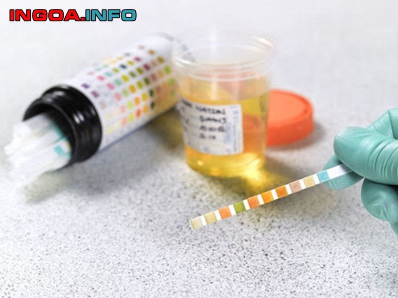 xet-nghiem-tpu-la-gi-y-nghia-tung-thong-so-trong-nuoc-tieu-7