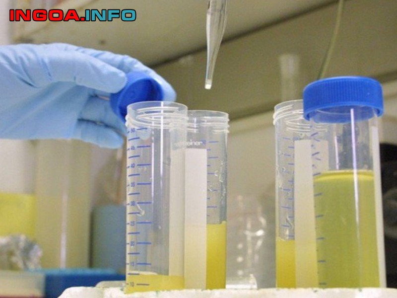 xet-nghiem-tpu-la-gi-y-nghia-tung-thong-so-trong-nuoc-tieu-8