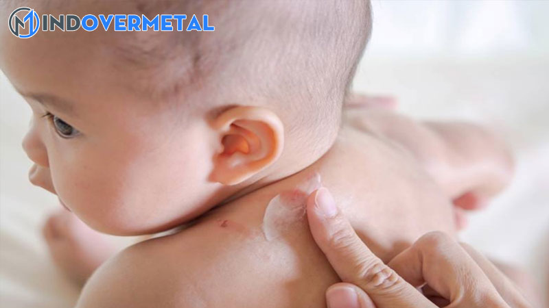 da-tre-so-sinh-noi-bong-sua-la-bi-benh-gi-2-mindovermetal