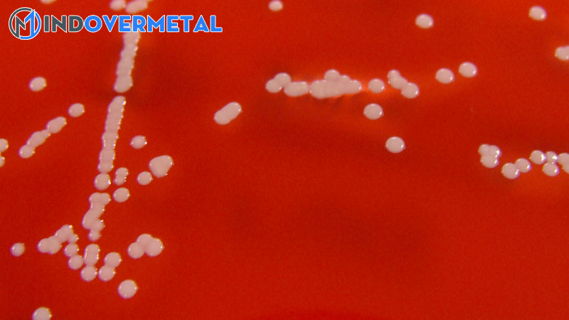 dac-diem-cua-staphylococcus-haemolyticus-phan-loai-hinh-thai-sinh-benh-hoc-2-mindovermetal
