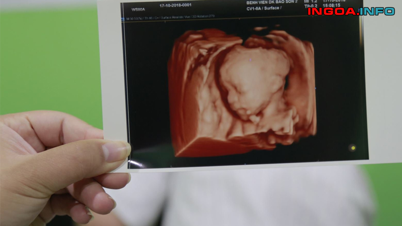 doppler-dong-mach-nao-giua-mindovermetal