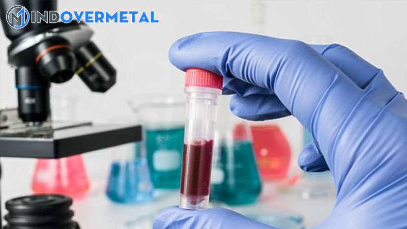 ket-qua-xet-nghiem-mau-gran-trong-xet-nghiem-mau-la-gi-8