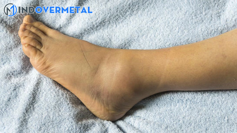 lua-chon-giay-da-bong-cho-ban-chan-thon-va-ban-chan-be-1-mindovermetal