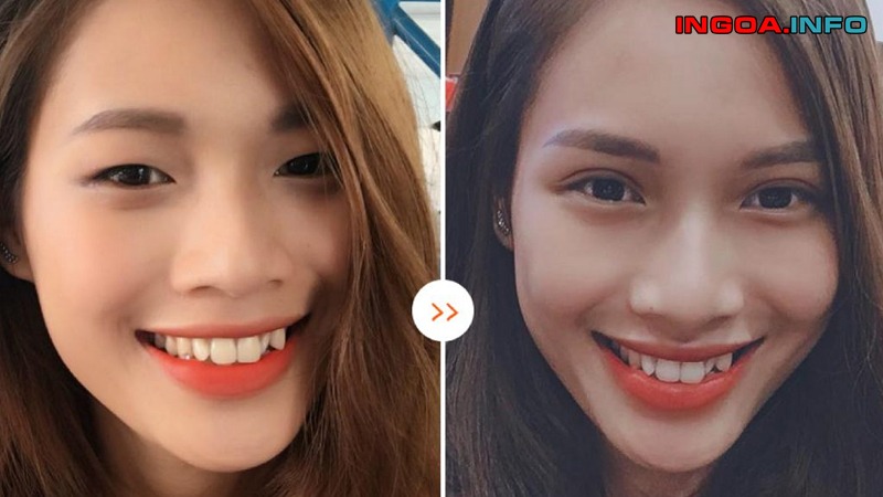 mat-sac-la-gi-doi-mat-sac-ben-noi-dieu-gi-cach-khac-phuc-hieu-qua-8