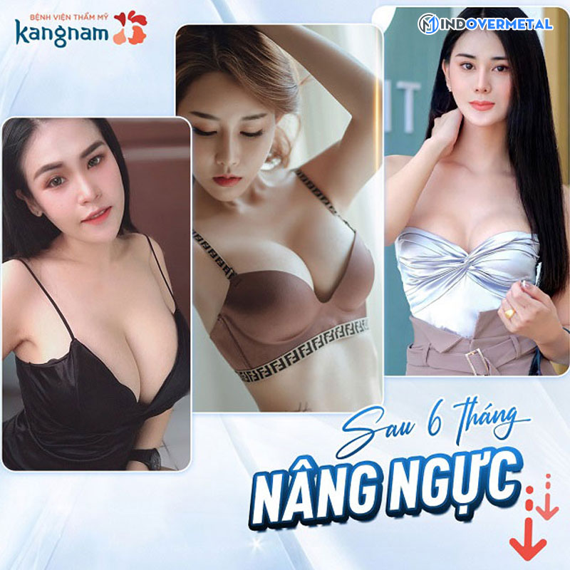 nang-nguc-an-toan-va-tu-nhien-tai-bv-kangnam-mindovermetal-3