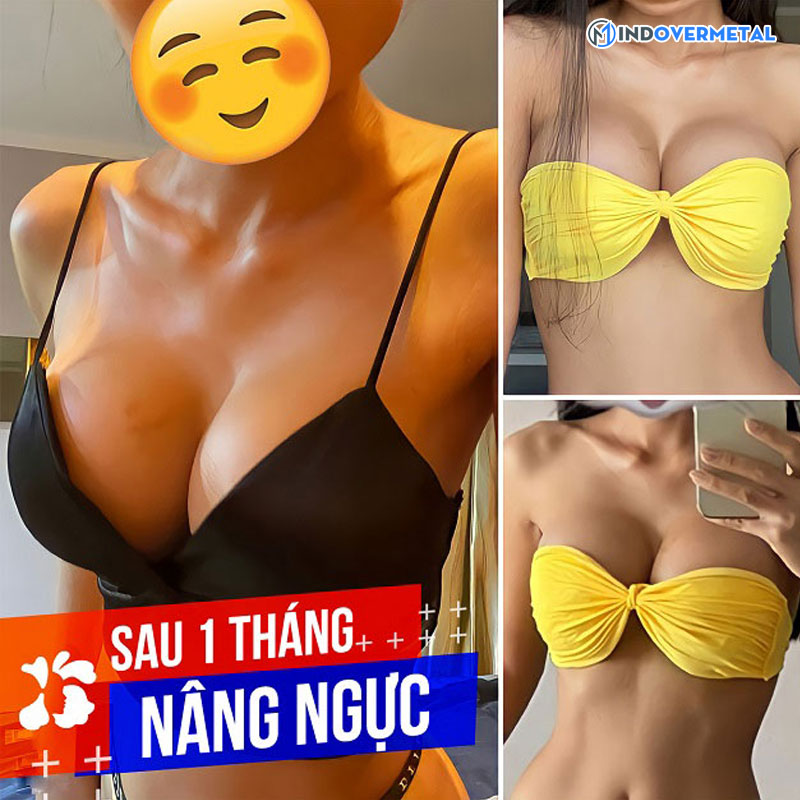 nang-nguc-an-toan-va-tu-nhien-tai-bv-kangnam-mindovermetal-4