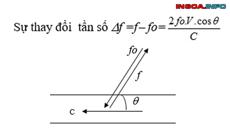 sieu-am-doppler-velocimetry-doppler-mindovermetal