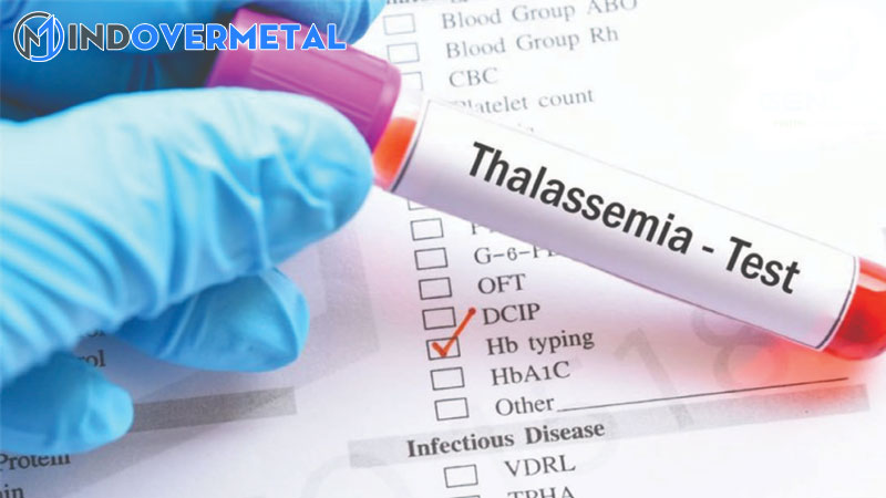 su-khac-biet-giua-hba-va-hbf-nhu-the-nao-2-mindovermetal