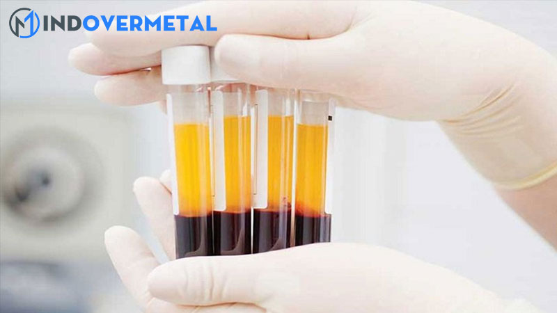 su-khac-biet-giua-huyet-tuong-va-dich-mo-khoa-hoc-tu-nhien-4