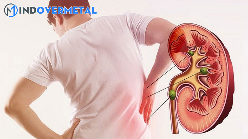 top-20-do-echogen-cua-than-la-gi-moi-nhat-2023-8