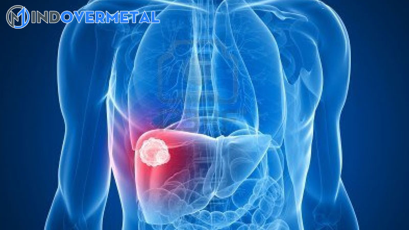 u-tan-sinh-chua-ro-tinh-chat-la-gi-nguyen-nhan-trieu-chung-chan-doan-3