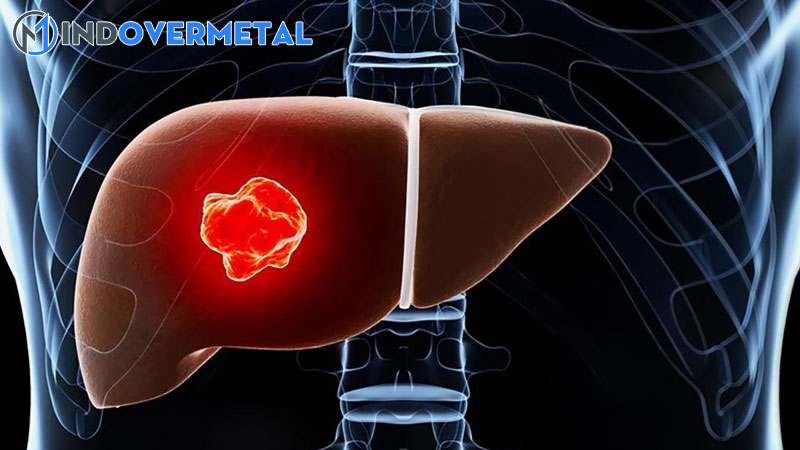 u-tan-sinh-chua-ro-tinh-chat-la-gi-nguyen-nhan-trieu-chung-chan-doan-7