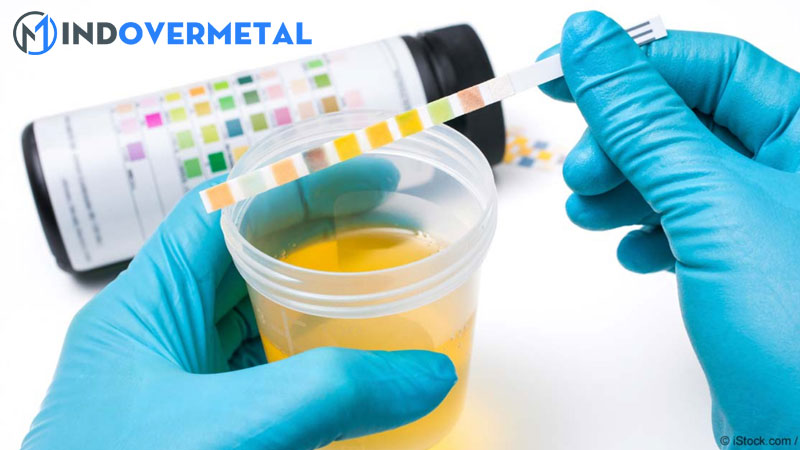 xet-nghiem-tong-phan-tich-nuoc-tieu-1-mindovermetal