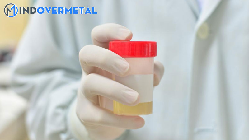 xet-nghiem-tong-phan-tich-nuoc-tieu-3-mindovermetal