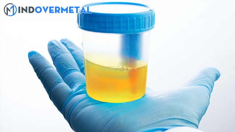 xet-nghiem-tong-phan-tich-nuoc-tieu-mindovermetal