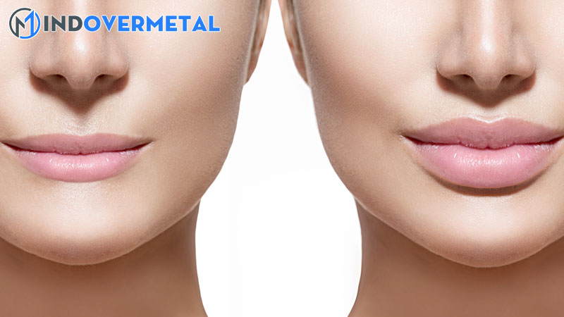 moi-tre-la-gi-co-xau-khong-cach-phuc-moi-tre-xoa-tan-tu-ti-4-mindovermetal