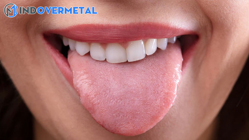 nhiet-mieng-tieng-anh-la-gi-nhung-tu-ngu-lien-quan-den-mieng-2-mindovermetal