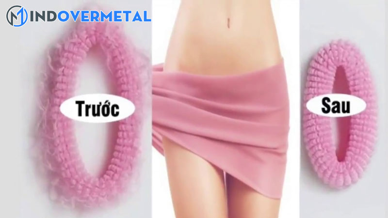 thu-nho-am-dao-la-gi-cac-phuong-phap-thu-hep-am-dao-hien-nay-1-mindovermetal