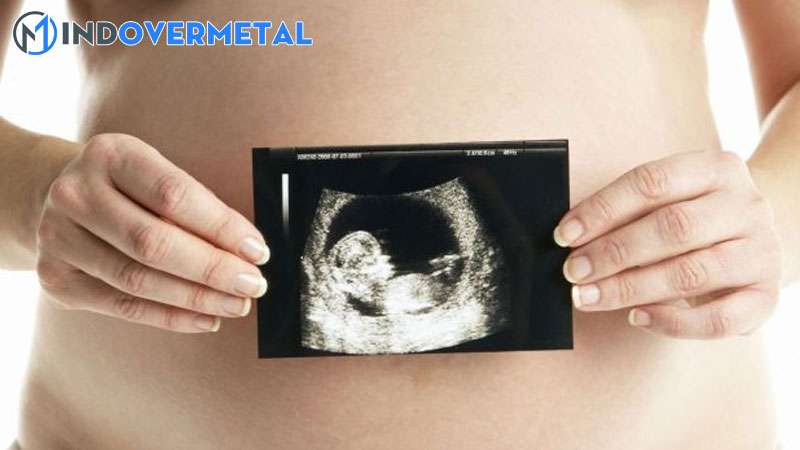 top-20-dau-hieu-notch-la-gi-moi-nhat-2023-mindovermetal