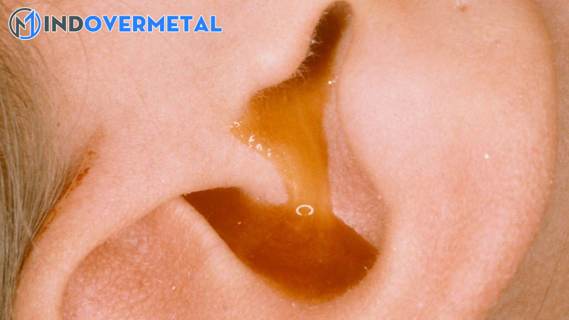 valsalva-tai-duong-tinh-la-gi-nhiem-trung-tai-tiet-dich-2-mindovermetal