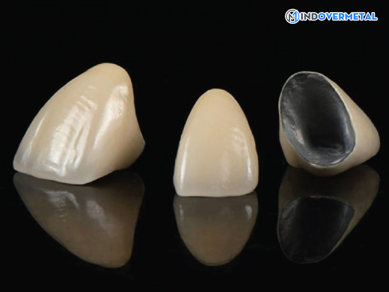 tong-hop-cac-loai-rang-su-pho-bien-mindovermetal